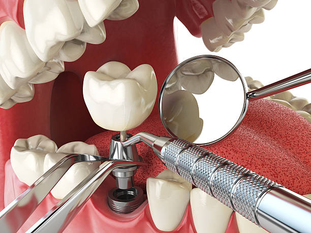 Best Weekend Emergency Dentist in Hudson, IL